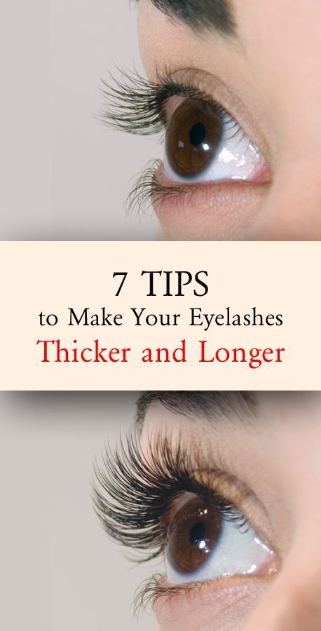 Brown Spots On Skin, Longer Lashes, How To Grow Eyelashes, Brown Spots Removal, Brown Spots On Face, Skin Spots, Spots On Face, Thicker Eyelashes, Long Lashes