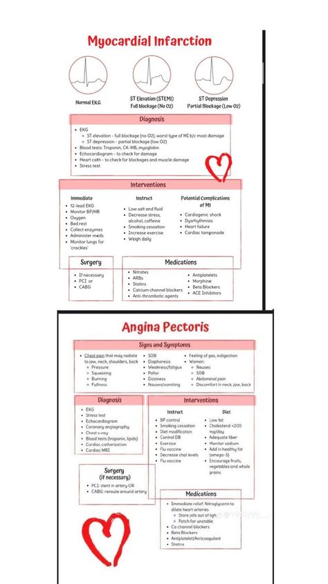 St Elevation, Cardiogenic Shock, Low Salt, Bed Rest, Nclex, Blood Test, Surgery, Medical