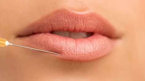 5 Causes of Cold Sores on Your Lips and How to Get Rid of Outbreaks | Marie Claire Cold Sore Remedy Overnight, Cold Sore Remedy, Cold Sore Stages, Cold Sore Lip, Blister On Lip, Burning Mouth, Zit Remedy, Home Remedies For Fever, Cold Sore Prevention