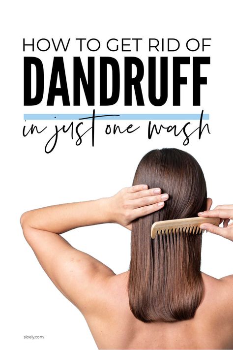 Learn how to get rid of dandruff in one wash with these overnight DIY dandruff treatments and remedies that can help you get rid of dandruff permanently naturally. #dandruff #dandruffremedy #dandrufftreatment How To Remove Dandruff, Severe Dandruff, Natural Dandruff Remedy, Hair Mask For Dandruff, How To Treat Dandruff, Home Remedies For Dandruff, Oils For Dandruff, Rid Of Dandruff, Peinados Aesthetic