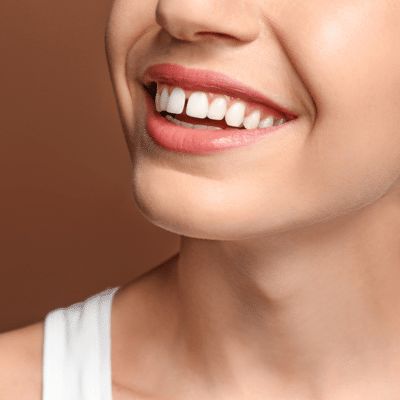 Gaps between teeth, also known as diastemas, can affect more than just the appearance of your smile. At Tomblyn Family Orthodontics, we understand that whether it's a small gap between your front teeth or larger spaces Gap In Teeth, Gap Between Teeth, Fix Teeth, Traditional Braces, Crooked Teeth, Gap Teeth, Clear Aligners, Teeth Braces, Metal Braces