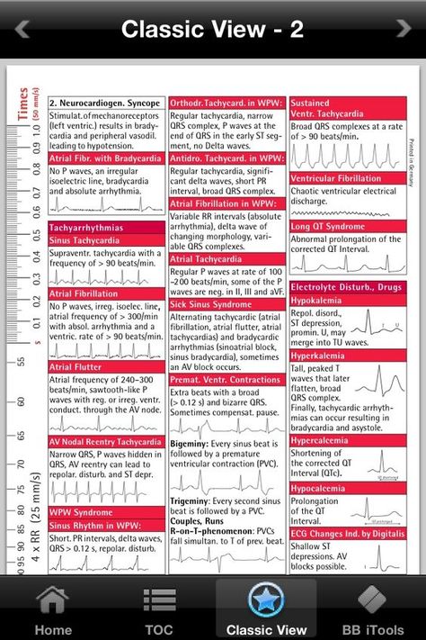 ekg interpretation cheat sheet | ECG i-Pocketcards â comprehensive pocket reference guide for ... Nursing Physical Assessment, Ekg Interpretation, Nursing Information, Cardiac Nursing, Critical Care Nursing, Nurse Rock, Respiratory Therapy, Nursing School Studying, Nursing Tips