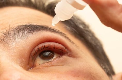 Which Medications Treat Styes? Bump On Eyelid, Eye Health Facts, Eye Safety, Laser Surgery, Insurance Benefits, Eye Surgery, Eyes Problems, Dry Eyes, Eye Health