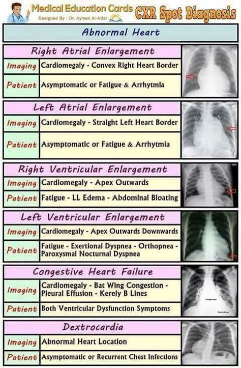 Important chest x ray Heart Nursing, Radiology Student, Radiology Imaging, Nursing Assessment, Heart Diseases, Cardiac Nursing, Nursing School Survival, Critical Care Nursing, Respiratory Therapy