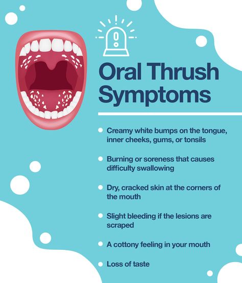 Some of you know a couple of weeks ago I came down with oral Thrush. After receiving medication it was resolved but after a few days it has returned. Peroxide Mouth Rinse, Kids Dental Health, Teeth Diseases, Gum Inflammation, Candida Overgrowth, Mouth Rinse, Teeth Whitening Diy, Candida Albicans, Teeth Health