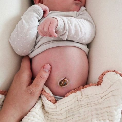 UMBILICAL CARE 👶 • The baby belly button is what is left of the umbilical cord after birth - once it's cut at birth, a small stump is left… Baby Umbilical Cord, Lace Baby Blanket, Snuggle Me, Gauze Blanket, Umbilical Cord, Postpartum Support, After Birth, Baby Belly, Instagram Giveaway