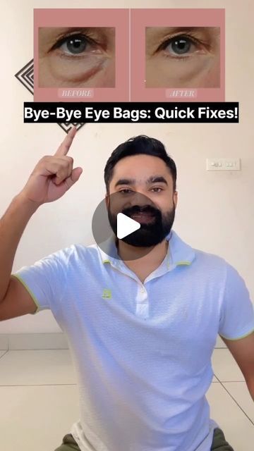 Eye Bags Remedy How To Get Rid, Gua Sha For Eye Bags, Get Rid Of Under Eye Bags, How To Remove Eye Bags, How To Get Rid Of Eye Bags, Remedies For Eye Bags, Baggy Eyes Remedy, Eye Bags Remedy, Face Excercise