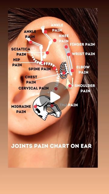 Dr. Aadil Khan on Instagram: "Ear acupuncture points have been widely known to relieve the pain associated with this physical issue. Acupuncture points on the ears may help relieve pain and tension around the body. Activating pressure points in the ear may help ease symptoms of several conditions.  #ear #auricular #acupuncture #acupressure #health #pain #organschart #organspoint #jointpain #ankle #shoulder #migraine #tmj #chest #wrist #ankle #knee #sciatica #cervical #acupuncturistaadilkhan   Disclaimer: This content is for educational purposes only and is not a substitute for professional medical advice. Please consult a doctor for any health concerns.  Disclaimer: Reposting this content without permission is prohibited. Please contact us for authorization." Ear Health Tips, Ear Acupuncture Points, Ear Acupressure Points, Auricular Acupuncture, Body Pressure Points, Painful Pimple, Ear Seeds, Ear Acupuncture, Acupuncture Benefits