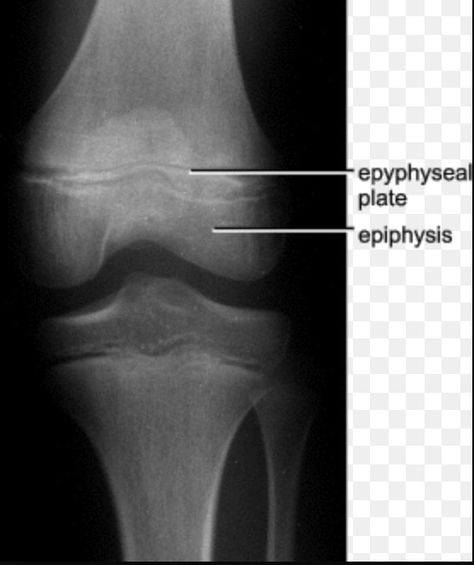 Synchondroses joint in epiphyseal plate: synarthrosis , one kind of cartilaginous joint . Connecting tissue is hyaline cartilage Epiphyseal Plate, Hyaline Cartilage, Handwritten Quotes, Free Education, The Bone, Occupational Therapy, Education, Quotes, Photography