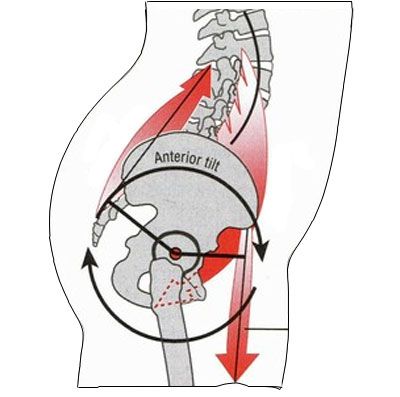 Anterior Pelvic Tilt Lower Belly Pooch, Psoas Release, Pelvic Tilt, Belly Pooch, Tight Hip Flexors, Muscles In Your Body, Tight Hips, Lower Belly, Hip Flexor