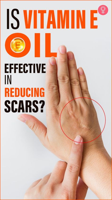 scar on a hand. vitamin E oil for scars on body. Benefits Of Vitamin E, Oils For Scars, Oil Skin, Oil Benefits, Oil Uses, Vitamin E Oil, Be Safe, Diy Face Mask, Vitamin E