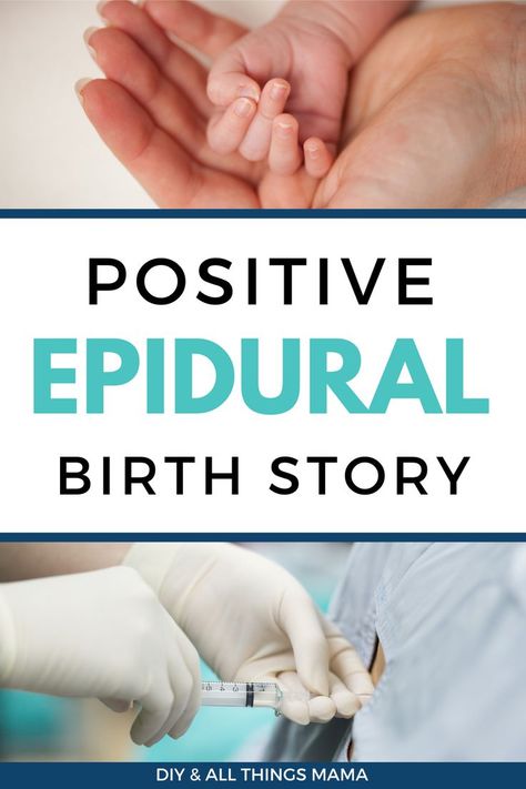 Epidural Side Effects, Epidural Birth, Labor Positions, Birth Story, Labor Delivery, Labor And Delivery, Birth Stories, Pros And Cons, A Thing