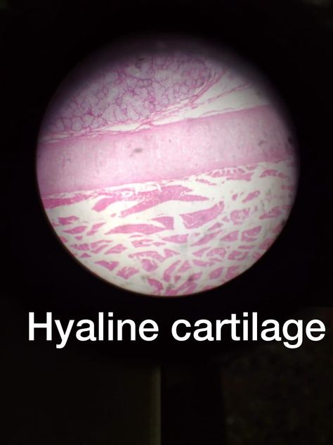 Hyaline Cartilage, Biology, Anatomy, Slides, Medicine, Quick Saves