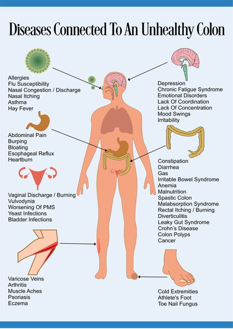 unhealthy colon Intestinal Cleanse, Colon Health, Natural Colon Cleanse, Colon Cleanse, Body Detox, Muscle Aches, Abdominal Pain, The Human Body, Digestive System