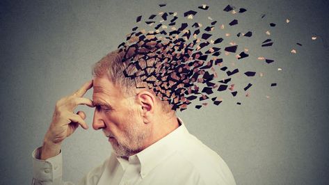 Memory loss due to dementia. Senior man losing parts of head  as symbol of decreased mind function. Types Of Memory, Brain Tissue, Diet Doctor, Stem Cell Therapy, Cell Therapy, Signs And Symptoms, Bone Health, Alzheimers, Brain Health