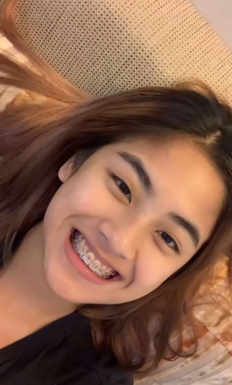 Behel Gigi, Braces Girl, Cute Braces Colors, Getting Braces, Savage Girl, Braces Girls, Cute Braces, Brace Face, Braces Colors