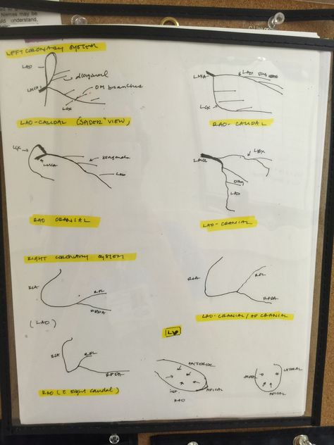 Angles for cardiac cath Cath Lab Technician, Cardiac Technician, Cardiac Cath, Lab Technician, Nursing School Notes, Smarty Pants, Anatomical Heart, Future Career, Cardiology