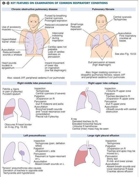 Common respiratory conditions Emt Study, Nursing Cheat, Nursing Information, Nursing Assessment, Nursing Mnemonics, Pulmonology, Respiratory Care, Critical Care Nursing, Nurse Rock