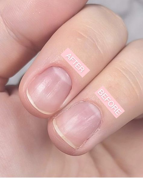 Kiara Sky Nails Official on Instagram: “STOP!✋🏼CAN WE TALK ABOUT A BEFORE AND AFTER!😍 Clean cuticles is literally the KEY to a gorgeous set, and GUESS WHAT? 👀👇​​​​​​​​ ​​​​​​​​…” Cuticles Before And After, Clean Cuticles, Kiara Sky, Sky Nails, Can We Talk, Clean Nails, Beautiful Makeup, Talk About, Key