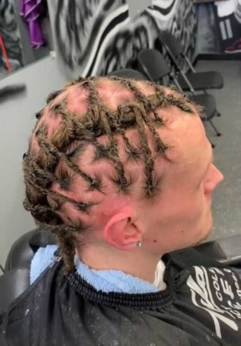 Ugly Hair, Dreadlock Hairstyles For Men, Bad Haircut, Dreadlock Hairstyles, Cornrow Hairstyles, Locs Hairstyles, Braids For Black Hair, Bad Hair, Hair Highlights