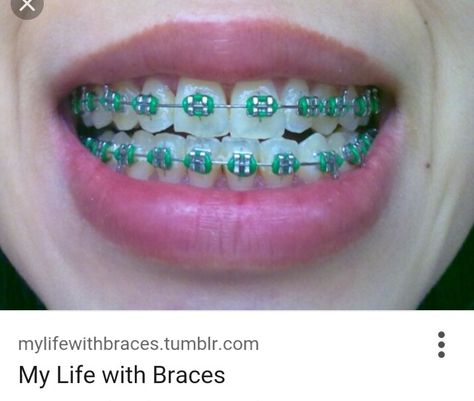 Green braces Dental Braces Colors, Braces Colors Combinations, Green Braces, Cute Braces Colors, Braces Cost, Kids Braces, Braces Tips, Getting Braces, Health Aesthetic