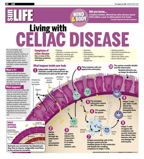 What Is Celiac, Celiacs Disease, Celiac Awareness Month, Celiac Symptoms, Celiac Diet, Celiac Awareness, Gluten Free Info, Coeliac Disease, Small Intestine