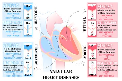 Aortic Regurgitation, Pulmonary Stenosis, Mitral Regurgitation, Mitral Stenosis, Cardiac Sonography, Med Surg Nursing, Mitral Valve, Nursing School Essential, Cardiovascular Disorders