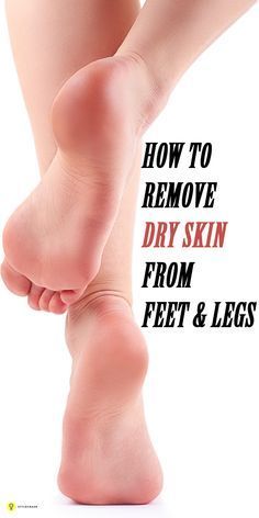 Dry skin on feet and legs occur when there is less humidity in air, especially in winter seasons. Here is how to remove #dryskin from legs and ... #makeuptipsdryskin Makeup Tips For Dry Skin, Skin Care Routine For 20s, Dry Skin Body, Dry Skin Remedies, Dry Skin Care, Skin Remedies, Flaky Skin, Prevent Wrinkles, Moisturizing Body Wash