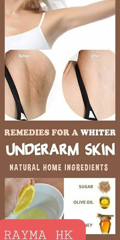 Rid Of Dark Underarms, Haut Routine, Natural Skin Care Remedies, Dark Underarms, Good Skin Tips, Brown Spots On Face, Beauty Tips For Glowing Skin, Perfect Skin Care Routine, Healthy Skin Tips