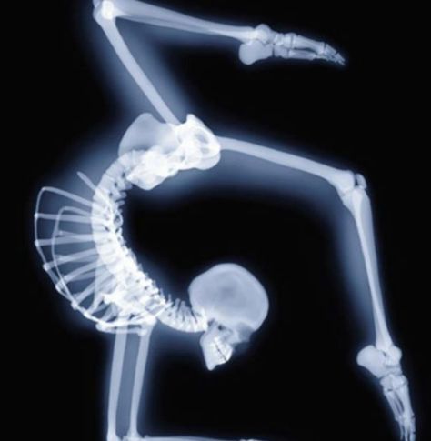 Awesome Dance Movement, Iyengar Yoga, A Skeleton, Dance Life, Lets Dance, Dance Art, Skeletal, Just Dance, X Ray