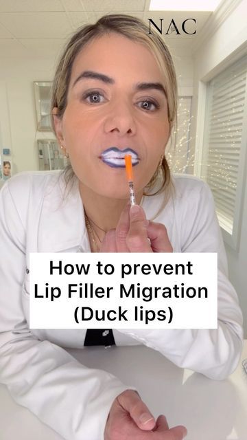 Dr. Bita Farrell on Instagram: "#lipfiller #lipfillermigration #ducklips #lipfillertraining #drbitafarrell #naturalaestheticscenter" Migrated Lip Filler, Lip Filler, Botox Fillers, Lip Fillers, November 1, Med Spa, Beauty Ideas, Spa, Lips