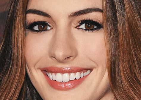 Celebrity Teeth, Perfect Smile Teeth, Anne Hattaway, Kate Holmes, Ann Hathaway, Beautiful Teeth, Smile Teeth, Perfect Smile, Keira Knightley