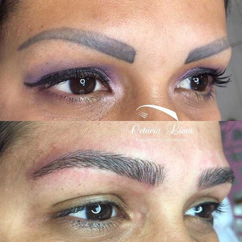 Laser Tattoo Removal Eyebrows, Remove Eyebrow Tattoo, Brow Tattoo Eyebrows, Eye Brows Tattoo Eyebrows, Eyebrow Tattoo Ideas, Bad Eyebrow Tattoo, Eye Brow Tattoo, Tattooed Eyebrows, Tattoo Brows