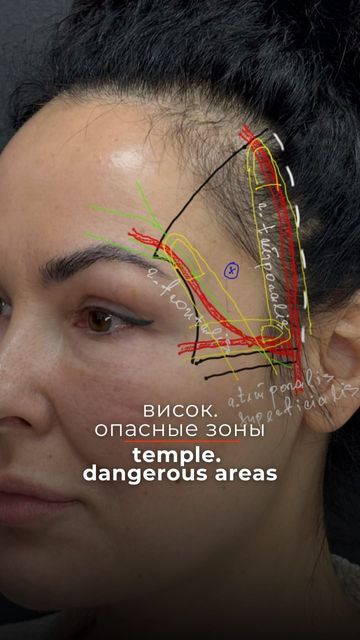 Arteries Anatomy, Face Fillers, Hyaluronic Acid Fillers, Facial Anatomy, Face Anatomy, Cosmetic Injectables, Facial Fillers, Aesthetic Medicine, Aesthetic Clinic