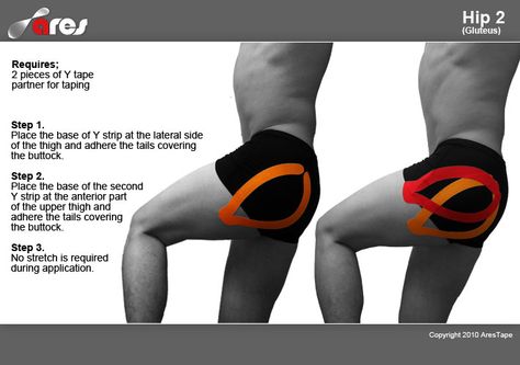 #HipPain #KinesiologyTapingInstructions Kt Tape Hip Flexor, Kt Tape Hip, K Tape, Bursitis Hip, Acupuncture Benefits, Sports Massage Therapy, Kt Tape, Piriformis Stretch, Kinesio Taping