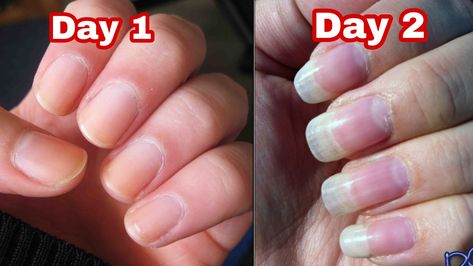 How To Grow Nails Faster In A Week, Fast Nail Growth, Grow Nails Fast, Grow Your Nails Faster, Nail Growth Faster, Nail Growth Tips, Grow Nails Faster, Fast Nail, How To Grow Nails