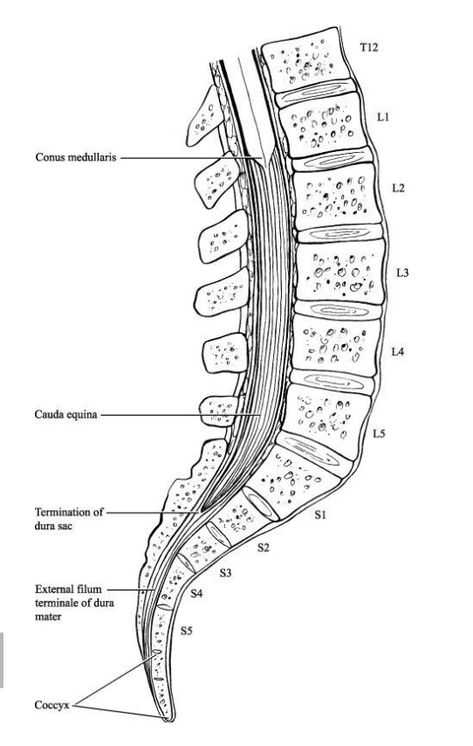 Cauda Equina Syndrome - Spine - Orthobullets Lumbar Vertebrae, Cauda Equina, Lumbar Disc, Physical Examination, Chronic Lower Back Pain, Motor Neuron, Spinal Nerve, Home Exercise Program, Peripheral Nerve