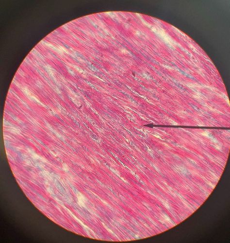 Collagen Fibers, Microscopic Images, Straight Lines, Noodles, Binding, Science