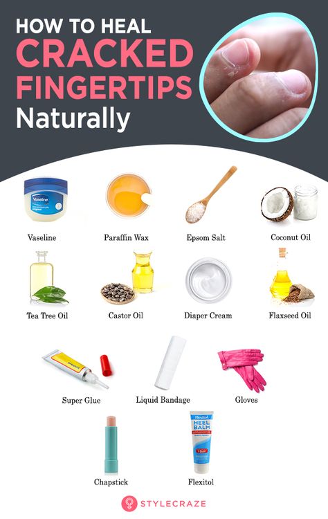 How To Heal Painful And Cracked Skin On The Fingertips Cracked Fingertips, Cracked Fingers, Cracked Heel Remedies, Vaseline Original, Heel Balm, Dry Cracked Hands, Cracked Hands, Routine Skin, Healing Ointment