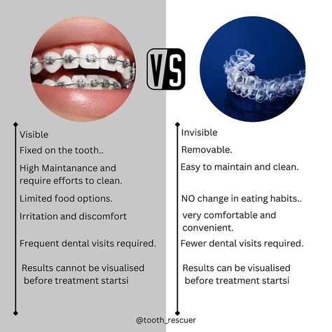 Metal braces vs. Invisalign: Which is right for you? Dive into the differences and discover your perfect smile solution! #BracesVsInvisalign #SmileJourney #toothrescuer #gibekhaa #dental #dentists #painfree #metalbraces #clearalligners #dentalalligners #smile #easy #beautiful Braces Clear, Invisalign Aligners, Teeth Alignment, Traditional Braces, Invisible Braces, Clear Braces, Clear Aligners, Metal Braces, Perfect Smile