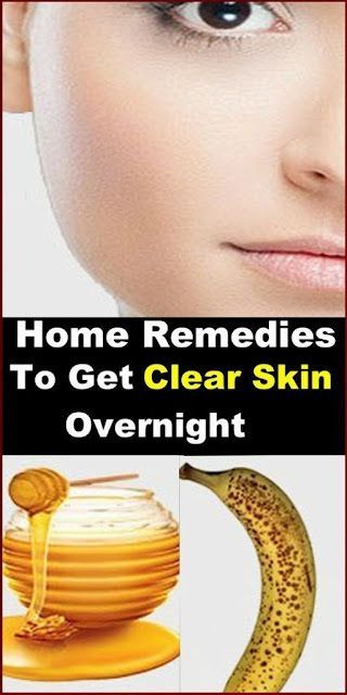 Home Remedies To Get Clear Skin Overnight Get Clear Skin Overnight, Overnight Remedies, Clean Clear Skin, Clear Skin Overnight, Health Resolutions, Clear Skin Naturally, Get Clear Skin, Health Articles Wellness, Natural Acne