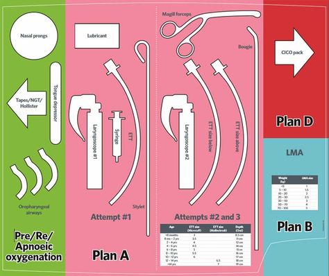 Vs Template, Anesthesia School, Emt Study, Nurse Anesthesia, Paramedic School, Airway Management, Nurse Anesthetist, Nursing Mnemonics, Hospital Nurse