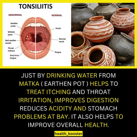 The Health Benefits of Drinking Water from an Earthen Pot Swollen Uvula, Improving Digestion, Benefits Of Drinking Water, Health Routine, Stomach Problems, Pure Water, Improve Digestion, Holistic Healing, Digestive Health