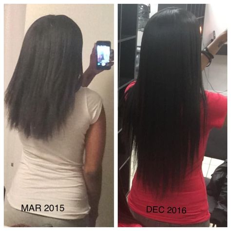 Alopecia Hair Growth, Hair Growth Progress, Hair Grow Oil, Natural Hair Journey Growth, Longer Hair Growth, Natural Hair Growth Oil, Straightening Natural Hair, Hair Butter, Herbal Hair