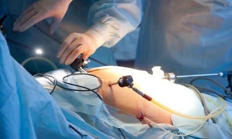 Department of Laparoscopic Gynecology Trouble Getting Pregnant, Gynecological Problems, Pelvic Organ Prolapse, Fertility Doctor, Robotic Surgery, Ivf Clinic, Internal Organs, Laparoscopic Surgery, Fertility Center