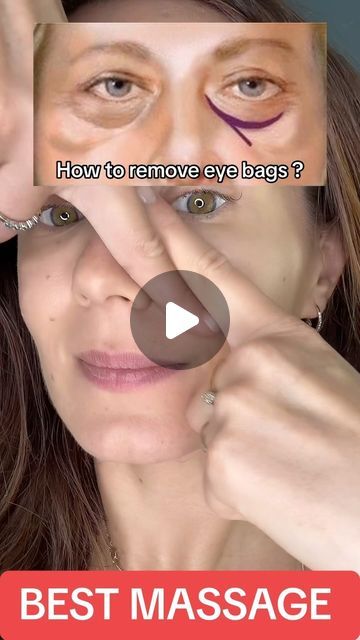 Eye Depuffing Massage, Under Eye Massage, Face Exercises For Eye Bags, Massage For Under Eye Bags, How To Reduce Eye Bags, Massage For Eye Bags, Eye Bags Remedy, Eye Massage For Tired Eyes, Eye Bags Makeup