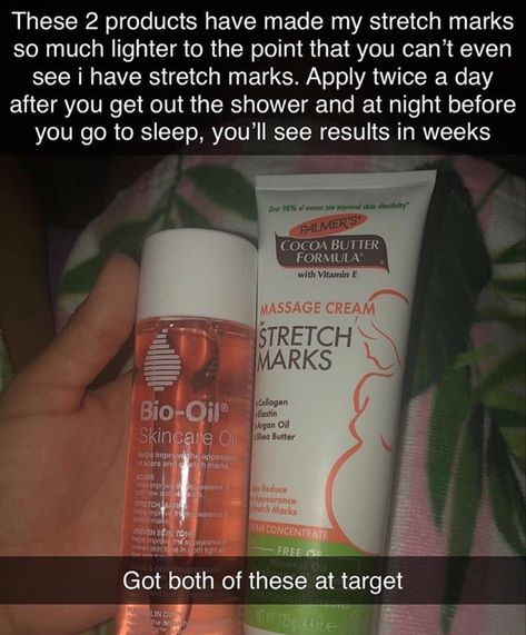 Strech Marks, Hygiene Care, Fotografi Digital, Beauty Tips For Glowing Skin, Stretch Mark, Healthy Skin Tips, Body Care Routine, Skin Care Remedies, Skin Care Solutions