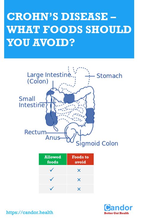 crohn's diet - what foods should you avoid Ibd Diet, Crohns Diet, Low Residue Diet, Sigmoid Colon, Ibs Diet, Gi Tract, Low Fodmap Diet, Large Intestine, Leg Pain