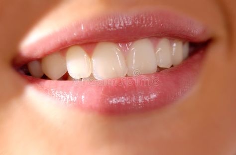 Vaseline Beauty Tips, Daily Beauty Tips, Get Whiter Teeth, Discolored Teeth, Laser Teeth Whitening, Dental Cosmetics, Gum Health, Natural Teeth, Perfect Smile