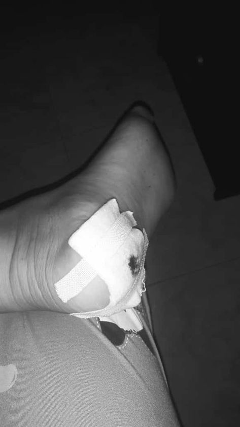 Fake Injury, Rauch Fotografie, Hospital Photography, Foot Injury, Hand Pictures, Emotional Photography, Best Poses For Pictures, Instagram Ideas Photography, Instagram Photo Inspiration